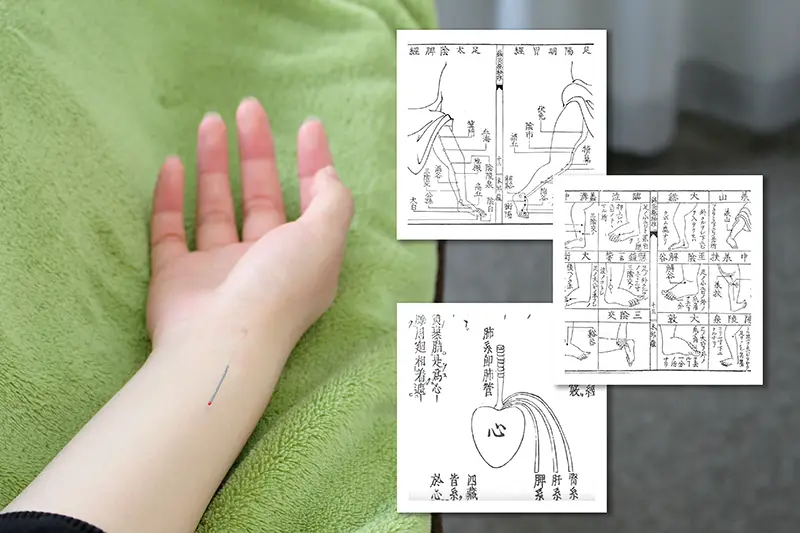 東洋医学的鍼灸施術のイメージ