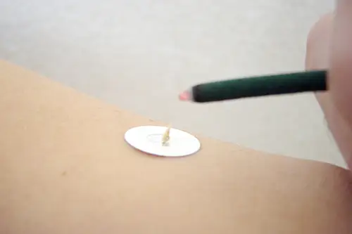 お灸のイメージ